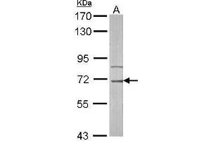 Image no. 3 for anti-Interleukin-1 Receptor-Associated Kinase 3 (IRAK3) (Center) antibody (ABIN2855791)