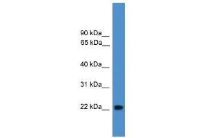 Image no. 1 for anti-Nudix (Nucleoside Diphosphate Linked Moiety X)-Type Motif 16-Like 1 (NUDT16L1) (Middle Region) antibody (ABIN928245)