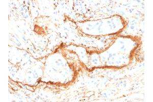 Image no. 3 for anti-Elastin (ELN) antibody (ABIN6939301)