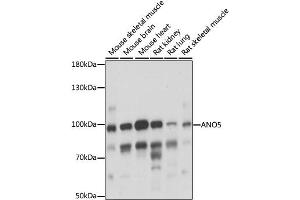 Image no. 1 for anti-Anoctamin 5 (ANO5) antibody (ABIN6291271)