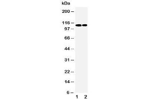 Image no. 2 for anti-Retinoblastoma-Like 1 (p107) (RBL1) (C-Term) antibody (ABIN3032468)