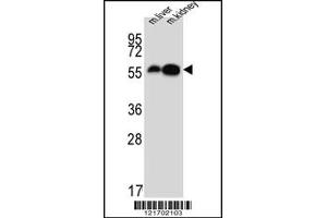 Western Blotting (WB) image for anti-Dopa Decarboxylase (Aromatic L-Amino Acid Decarboxylase) (DDC) antibody (ABIN2160522)
