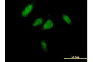 Immunofluorescence of purified MaxPab antibody to CCND3 on HeLa cell.