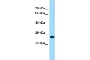 Image no. 1 for anti-MOB1, Mps One Binder Kinase Activator-Like 1B (MOBKL1B) (C-Term) antibody (ABIN2790218)