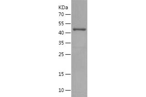 IKBKG Protein (AA 183-339) (GST tag)