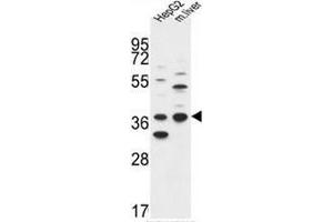 Image no. 1 for anti-Dehydrogenase/reductase (SDR Family) Member 3 (DHRS3) (AA 92-121), (Middle Region) antibody (ABIN951904)
