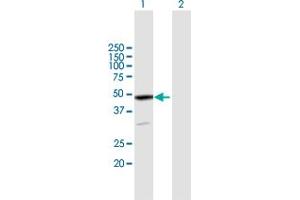 Image no. 2 for anti-erythrocyte Membrane Protein Band 4.9 (Dematin) (EPB49) (AA 1-383) antibody (ABIN515325)