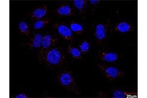 Proximity Ligation Assay (PLA) image for HSPB1 & F13A1 Protein Protein Interaction Antibody Pair (ABIN1339786)