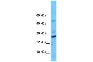 Image no. 1 for anti-Nudix Hydrolase 8 (NUDT8) (N-Term) antibody (ABIN2791709)