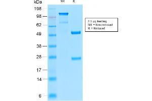 Tyrosinase-Related Protein 1 anticorps  (AA 257-377)