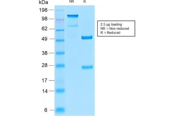 Tyrosinase-Related Protein 1 anticorps  (AA 257-377)