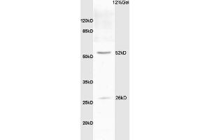 Image no. 1 for anti-BCL2-Like 1 (BCL2L1) (AA 81-200) antibody (ABIN675129)