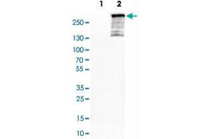 Image no. 2 for anti-AT Rich Interactive Domain 1A (SWI-Like) (ARID1A) antibody (ABIN5649786)