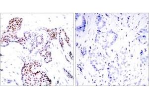 Image no. 2 for anti-ELK1, Member of ETS Oncogene Family (ELK1) (AA 356-405), (pSer389) antibody (ABIN1531827)