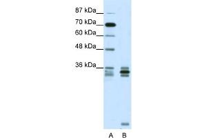 Image no. 2 for anti-Oligodendrocyte Lineage Transcription Factor 2 (OLIG2) (C-Term) antibody (ABIN2777566)