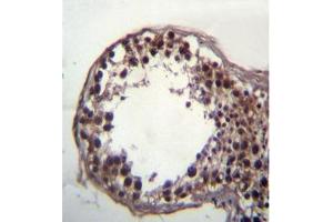 Image no. 1 for anti-Deleted In Azoospermia 3 (DAZ3) (AA 396-426), (C-Term) antibody (ABIN951839)