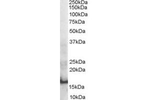 Image no. 1 for anti-SH2 Domain Containing 1A (SH2D1A) (Internal Region) antibody (ABIN185426)