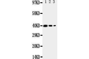 Image no. 2 for anti-Methyl-CpG Binding Domain Protein 4 (MBD4) (AA 566-580), (C-Term) antibody (ABIN3044062)