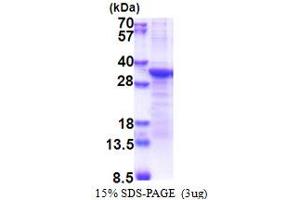 Image no. 1 for Proprotein Convertase Subtilisin/kexin Type 1 Inhibitor (PCSK1N) (AA 34-260) protein (His tag) (ABIN6387353)