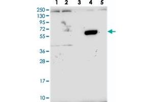 Image no. 1 for anti-Zinc Finger Protein 837 (ZNF837) antibody (ABIN5591466)