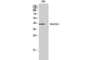 Image no. 1 for anti-Acyl-CoA Wax Alcohol Acyltransferase 1 (AWAT1) (C-Term) antibody (ABIN3184289)