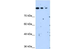Image no. 3 for anti-SET Domain Containing 2 (SETD2) (N-Term) antibody (ABIN2783051)