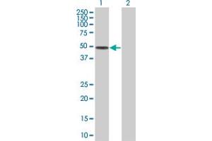 Image no. 1 for anti-Complement Factor I (CFI) (AA 1-377) antibody (ABIN516813)
