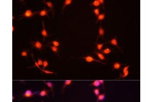 Immunofluorescence analysis of U-251MG cells using S100B Polyclonal Antibody at dilution of 1:100 (20x lens).