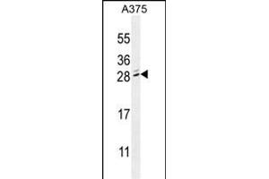 MBD3L2 antibody  (C-Term)