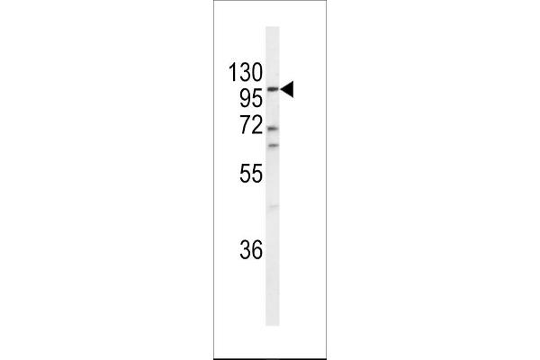 anti-Endothelin-Converting Enzyme 1 (ECE1) (AA 528-556), (C-Term) antibody