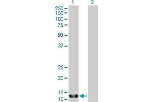 anti-Serine/threonine Kinase 10 (STK10-A) (AA 12-144) antibody