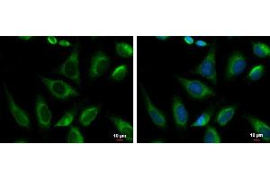 Image no. 3 for anti-Protein Kinase C Substrate 80K-H (PRKCSH) (Center) antibody (ABIN2855219)
