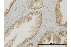 Image no. 1 for anti-Acid Phosphatase, Prostate (ACPP) (AA 1-386) antibody (ABIN513082)