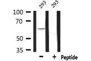 Image no. 3 for anti-Ceramide Kinase-Like (CERKL) (Internal Region) antibody (ABIN6260772)