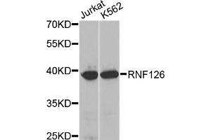 Image no. 1 for anti-Ring Finger Protein 126 (RNF126) antibody (ABIN1874619)