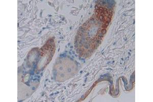 Image no. 4 for anti-Sciellin (SCEL) (AA 410-652) antibody (ABIN5014294)