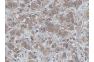 Image no. 3 for anti-Host Cell Factor C1 (VP16-Accessory Protein) (HCFC1) (AA 52-258) antibody (ABIN5013712)