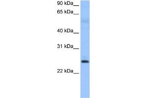 ROPN1B anticorps  (N-Term)