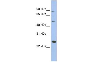 Image no. 1 for anti-Matrilin 3 (MATN3) (Middle Region) antibody (ABIN2786653)