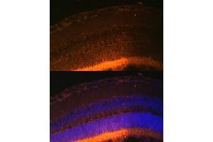 GRK1 antibody  (AA 1-160)
