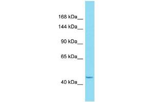Image no. 1 for anti-HEAT Repeat Containing 6 (HEATR6) (C-Term) antibody (ABIN2791575)