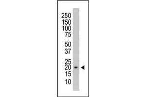 Image no. 1 for anti-Protein Tyrosine Phosphatase Type IVA, Member 3 (PTP4A3) antibody (ABIN356421)