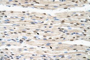 Image no. 2 for anti-Heterogeneous Nuclear Ribonucleoprotein D-Like (HNRPDL) (AA 119-168) antibody (ABIN203083)