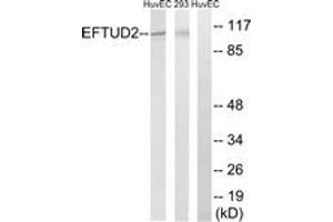Image no. 1 for anti-Elongation Factor Tu GTP Binding Domain Containing 2 (EFTUD2) (AA 321-370) antibody (ABIN1534496)