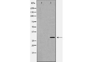 Image no. 2 for anti-Kv Channel Interacting Protein 3, Calsenilin (KCNIP3) (Internal Region) antibody (ABIN6260422)