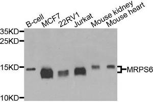 anti-Mitochondrial Ribosomal Protein S6 (MRPS6) antibody