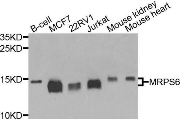 anti-Mitochondrial Ribosomal Protein S6 (MRPS6) antibody