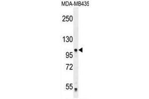 Image no. 1 for anti-Protocadherin alpha 5 (PCDHA5) (AA 294-323), (Middle Region) antibody (ABIN954033)