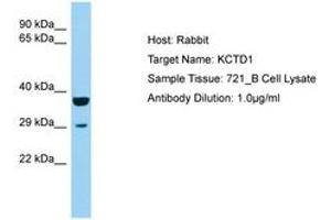 Image no. 1 for anti-Potassium Channel Tetramerisation Domain Containing 1 (KCTD1) (AA 110-159) antibody (ABIN6750204)