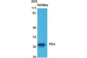 Image no. 2 for anti-Prostate Stem Cell Antigen (PSCA) (Internal Region) antibody (ABIN3186575)